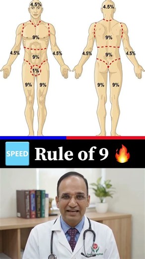 Rule of Nines in Burns 🔥 Calculate TBSA in Seconds