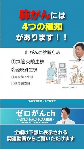 肺がんには4つの種類があります #肺がん #がん #がん専門医