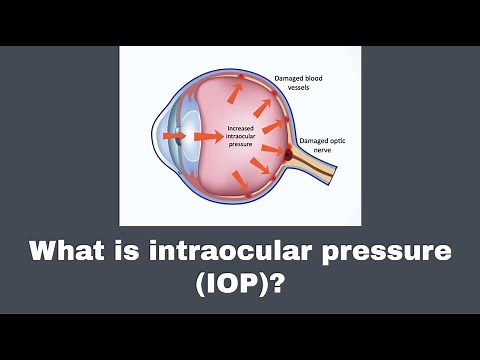 What is intraocular pressure (IOP) ?