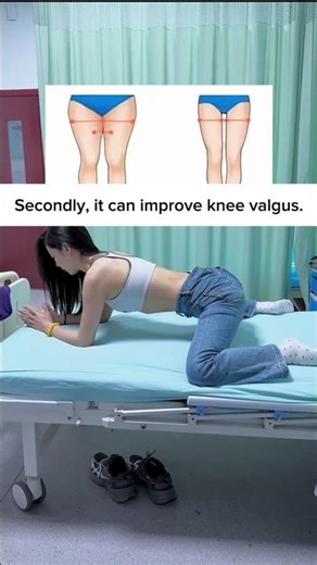 🔥 Fix Bowlegs & XO-Legs FAST! 🐸Frog Pose Benefits + How-To #BowlegsFix#YogaForLegs#legswelling#myleg