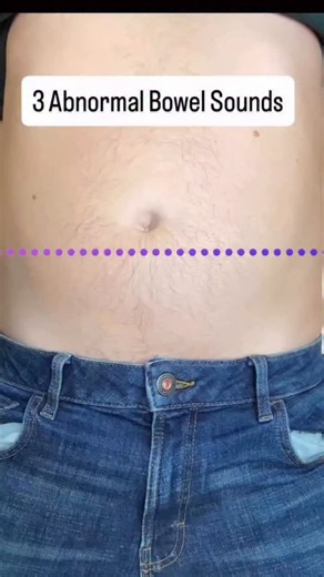 BALAJI medical education on Instagram: "3 abnormal bowel sounds. . . #bowel #stethoscope #mbbs #mbbsstudent #viral #medical #tranding #nursing #doctor #nursingstudent #doctors #abdomen #neetpg #fmge"