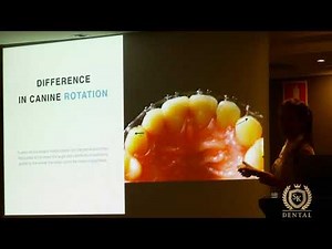 T scan and Orthodontics by Dr Svitlana Koval