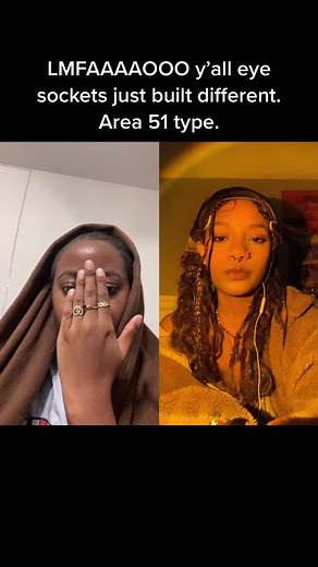 Unique Eye Sockets: The Area 51 Connection