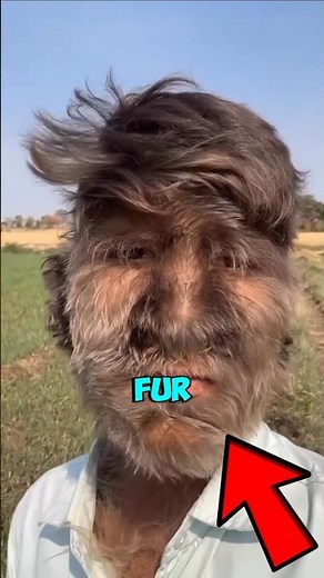 The Human Werewolf Nobody Believed