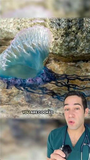 Doctor Reacts: swimming with jellyfish?!
