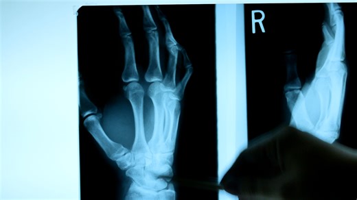 Need urgent orthopedic care? OrthoCare ASAP by LifeBridge Health is available for walk-in care. From sprains to broken bones, specialists are available to help. | WBAL-TV 11 Baltimore
