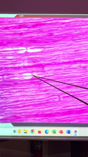 BIOL 157 Peripheral Nerve Slide Longitudinal Section