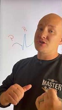 The R on T Phenomenon