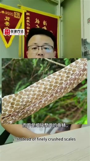 Do you know the origins of the names for ichthyosis in Western and Traditional Chinese medicine?
