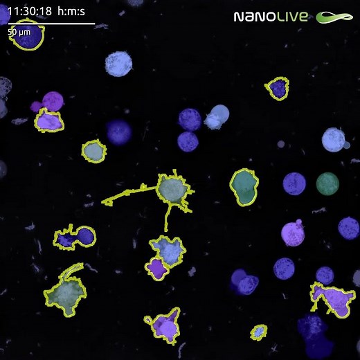 LIVE Cytotoxicity Assay subpopulation segmentation