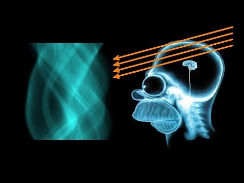 Wie funktioniert ein CT? (Computertomographie, Radon-Transformation)