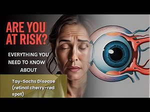 Tay-Sachs Disease (retinal cherry-red spot) Explained Causes, Symptoms and Treatment, All Insights