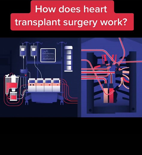 Understanding Heart Transplant Surgery Process