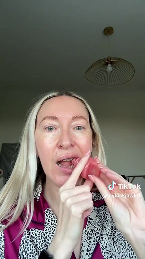 9 Days of Jaw Therapy: Progress & Frustration