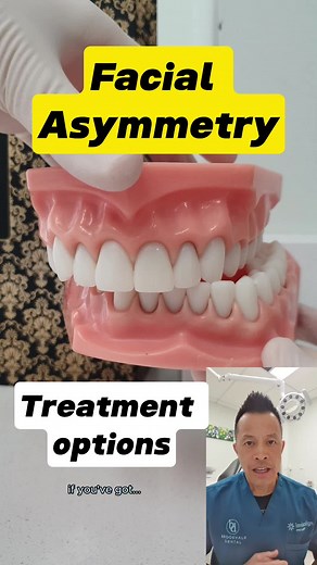 Facial Asymmetry Treatment: What Are Your Options? #dentallan #dentist #facialasymmetry #facialasymmetrical #mandibular #mandible #lowerjaw #faceasymmetry #facesymmetry #Bite #occlusion #crossbite #crossbiteproblems #crossbites #scissorsbite #jawasymmetry #midline #dentalmidline #teethasymmetries #midlineshift #midlinecorrection #jawsurgery #orthognathicsurgery