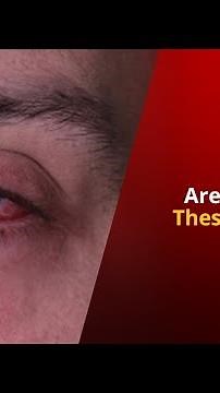 Black Fungus: What Symptoms To Look Out For | NewsMo