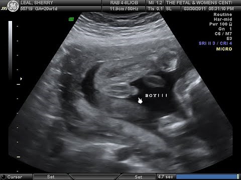 Ultrasound of baby boy at 26 weeks!!! | Part 2 |