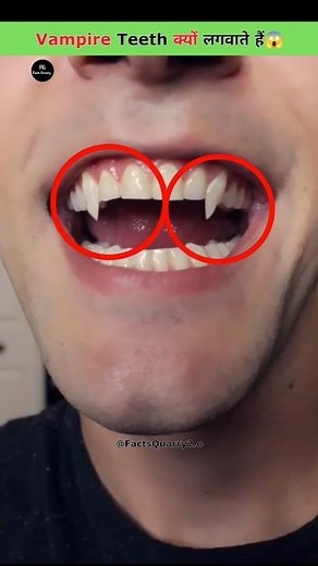 Why People Have Vampire Teeth