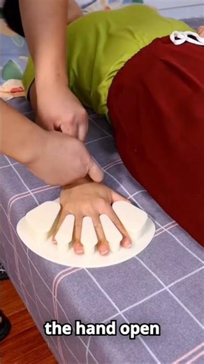 How to fix "Claw Hand" at home