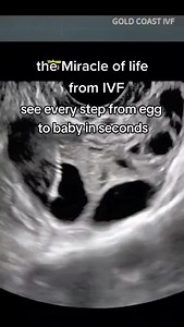 24K views · 514 reactions | see every stage of Ivf from egg to baby - the miracle of life #infertility #IVF #ttc #Reels #Reel #reelsvideo #reelsviral #reelsfb #reelsinstagram | Steven Palter | Facebook
