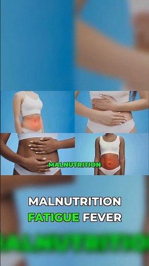 Crohn's Symptoms & Pain: Where to Look for Clues!