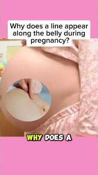 Why This Dark Line Appears During Pregnancy 🤰 (Linea Nigra Explained!)#baby #momlife #shorts