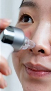 Most Expensive Blackhead Removal Tool Review & Demo: Does It Work?