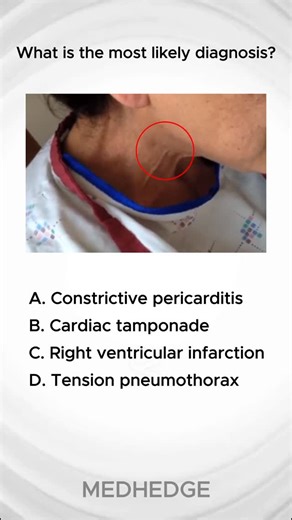 follow for more 🩺 on Instagram: "Answer in poll⤵️"