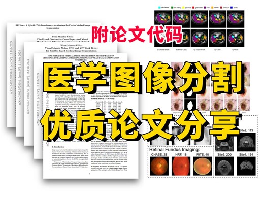 【附论文代码】2024年医学图像分割优质论文Medical Image Segmentation！ CNN-Transformer