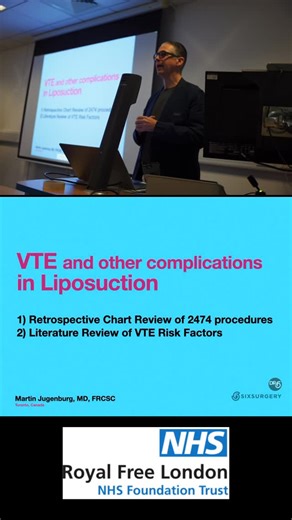 Dr Martin Jugenburg (Dr6ix) - Plastic Surgeon on Instagram: "This morning I had the honor of speaking at the Royal Free Hospital Plastic Surgery rounds in London UK, sharing my experience with 2474 liposuction procedures, using retrospective chart review to analyze various risk factors to determine what can increase risk of blood clots and pulmonary embolism. The findings were pretty surprising, and I hope my presentation will help improve awareness and decrease morbidity and mortality in cosmet