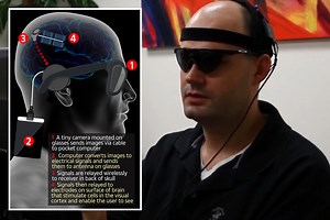 Doctors restore patients' sight with video camera and brain implant
