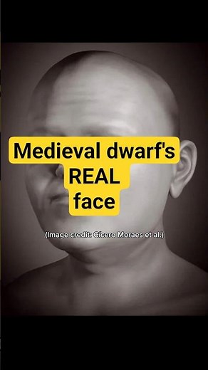 This is what a medieval man with dwarfism REALLY looked like #history #facereveal #medieval