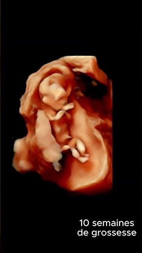 3D Journey: Discover a 10-Week-Old Fetus #3d #embryology #pregnancy #sonography
