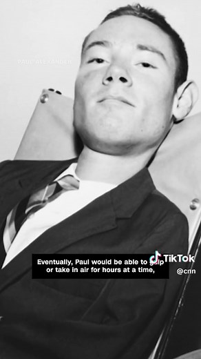 Paul Alexander developed polio at the age of 6. The disease left Paul paralyzed from the neck down and unable to breathe on his own. He was placed in an iron lung, a large metal cylinder that varies air pressure to stimulate breathing. Paul died at age 78, accomplishing more than anyone thought was possible. #polio #obituary #ironlung #cnn #news