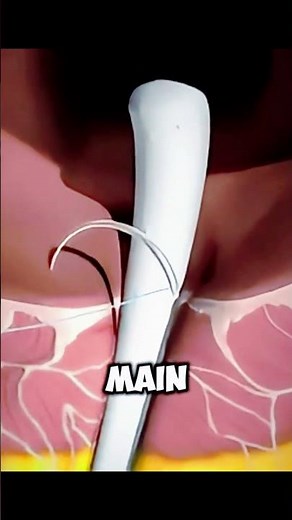 How Fistula Repair Surgery Heals Infections | 3D Medical Animation Explained #facts #science
