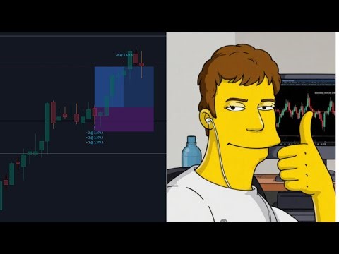 Footprint Chart : The Most Powerful Trading Tool (Trade Breakdown)