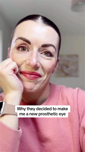 New Prosthetic Eye: Insights and Journey After Surgery