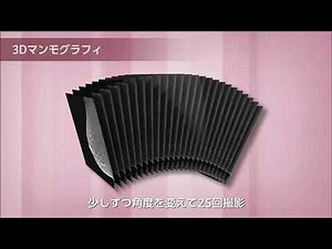 3Dマンモグラフィ