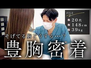 【148㎝体重39㎏で脂肪豊胸に挑む】Dカップってこんなん？胸がそげてる？