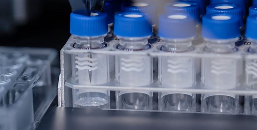 HPLC Purification: When to Use Analytical, Semi-Preparative & Preparative Methods