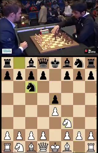 The shortest game of MagnusCarlsen's chess career!