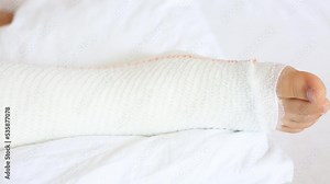 Children's leg in orthopedic cast on a white bed in the orthopedic department after first aid. Broken leg in a cast of an young child. Stock Video