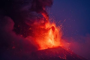 Dr. Pimple Popper Squeezes A Big Blackhead And A Giant Cyst In A New Video