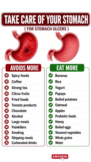 Take care of your stomach (ulcer edition) | improve health | eat smart |