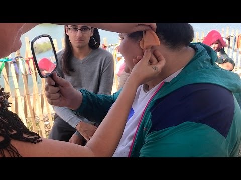HER LIFE CHANGING SURGERY!!