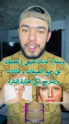 Mohammed boucherif on Instagram‎: "وصفة ( ماسك طبيعي ) يقضيلك على جميع التصبغات و طاشات و يسترجع لكي نضارة البشرة ( مايكونكش مسمومة بارطاجيها مع صحباتك 😁❤️ )"‎