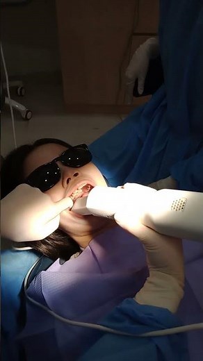 IntraOral Scan