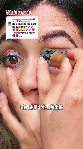 Lip Beauty Hack! Remove Blackheads Instantly & Glow Like Never Before