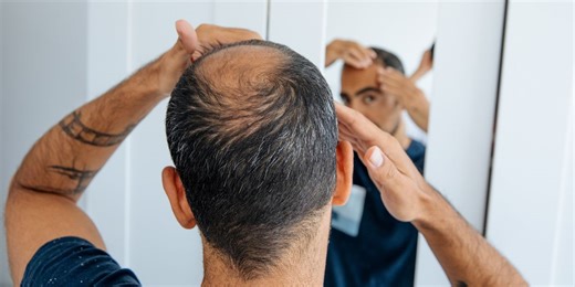 This Breakthrough Drug May Be the Ultimate Baldness Cure. Here's What Scientists Say.