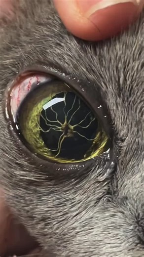 Dr Eyes Without A Face on Instagram: "Credit to @drvicki_eyevet When you look into an eye… and a spider looks back 🕷️👁️ This beautiful Burmese was seen at VSS Jindalee with some of the most incredible persistent pupillary membranes (PPMs) I’ve seen. PPMs are remnants of foetal blood vessels that normally regress before birth. In this case, the strands formed a striking “spider-like” configuration — with a central adhesion on the anterior pole of the lens and delicate filamentous “legs” extendi